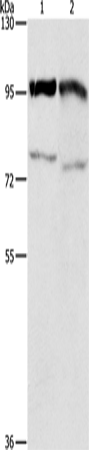 Rabbit Polyclonal Antibody to EZH2