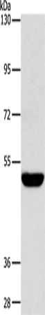 Rabbit Polyclonal Antibody to SPTLC1
