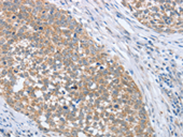 Rabbit Polyclonal Antibody to PAPSS1