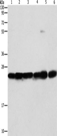 Rabbit Polyclonal Antibody to SIGMAR1