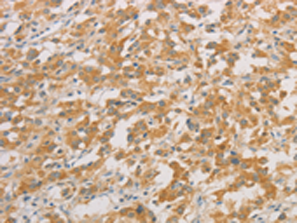 Rabbit Polyclonal Antibody to ZWINT