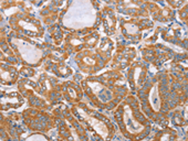 Rabbit Polyclonal Antibody to MTMR7
