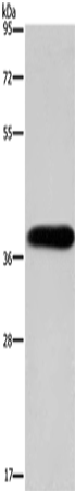 Rabbit Polyclonal Antibody to PITX2