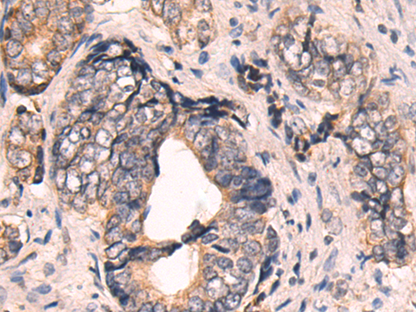 Rabbit Polyclonal Antibody to GRK3