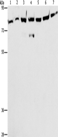 Rabbit Polyclonal Antibody to PRKCE