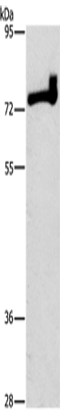 Rabbit Polyclonal Antibody to PRKCD