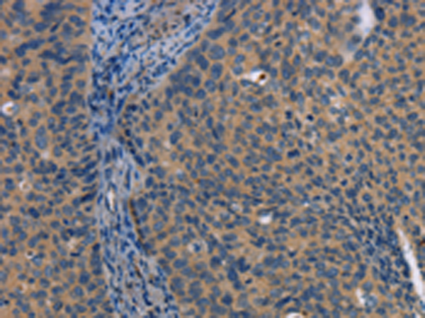 Rabbit Polyclonal Antibody to LATS1