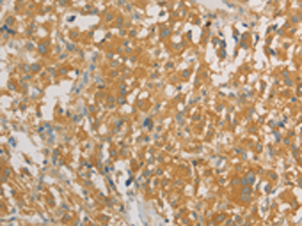 Rabbit Polyclonal Antibody to PRPSAP1