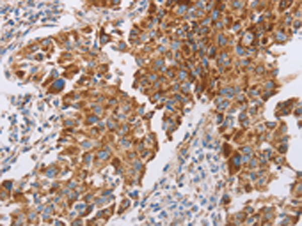 Rabbit Polyclonal Antibody to GUCY1A1