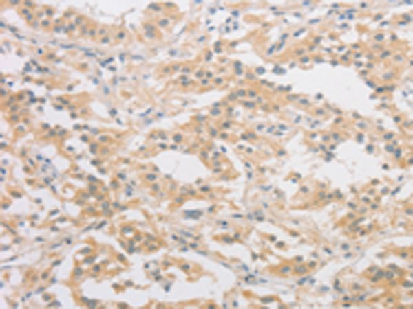 Rabbit Polyclonal Antibody to HIPK4