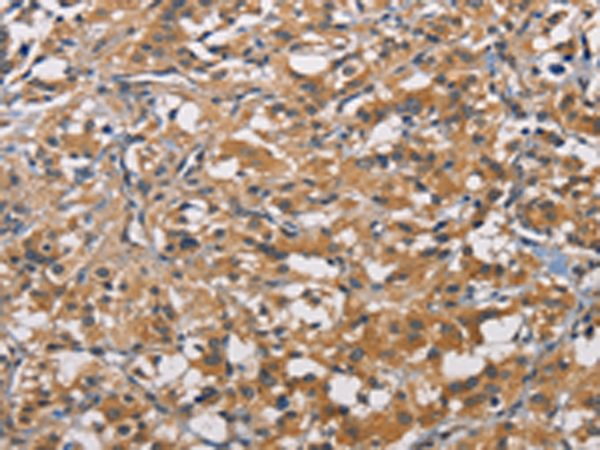 Rabbit Polyclonal Antibody to PIKFYVE
