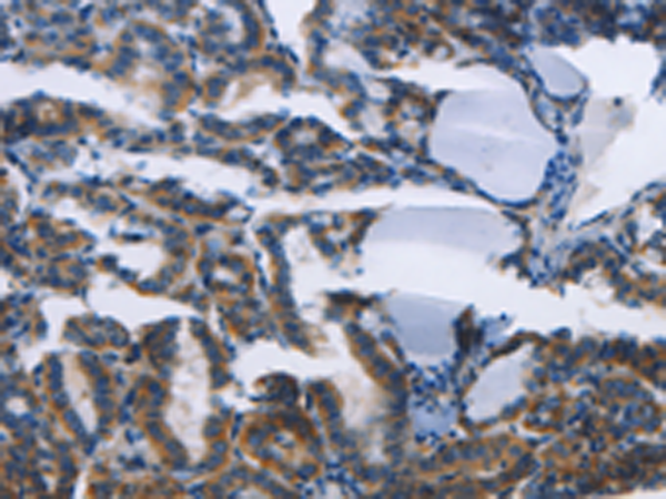 Rabbit Polyclonal Antibody to TWF2