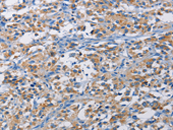 Rabbit Polyclonal Antibody to RICTOR
