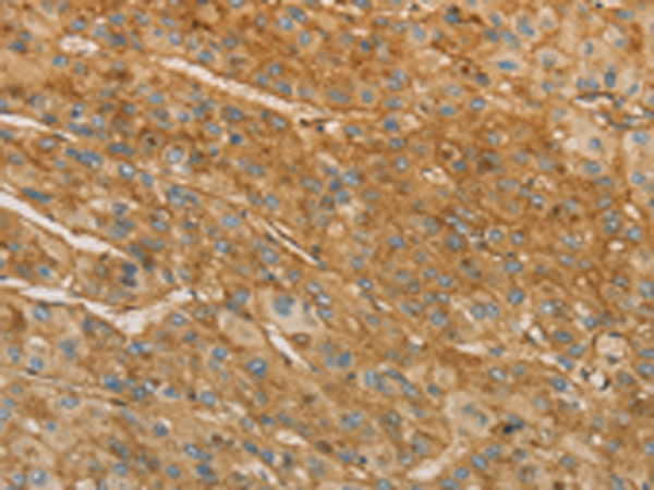 Rabbit Polyclonal Antibody to VTN