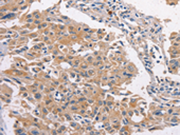 Rabbit Polyclonal Antibody to MAPK15
