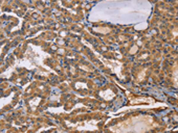 Rabbit Polyclonal Antibody to EPHB6