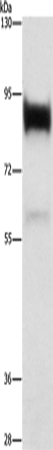 Rabbit Polyclonal Antibody to LTF