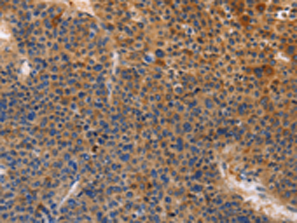 Rabbit Polyclonal Antibody to MUSK