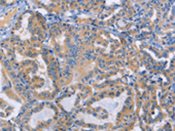 Rabbit Polyclonal Antibody to DOK4