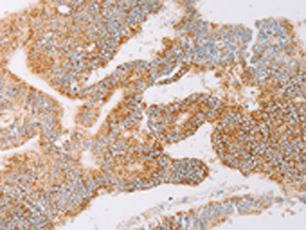 Rabbit Polyclonal Antibody to YARS2
