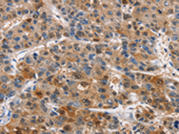 Rabbit Polyclonal Antibody to PIM1