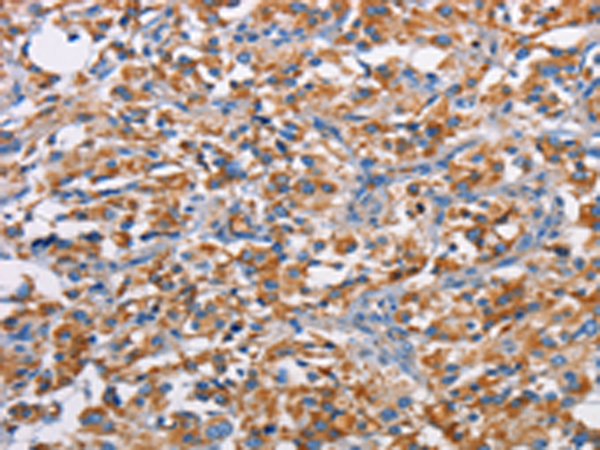 Rabbit Polyclonal Antibody to PIM2