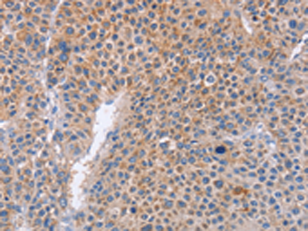 Rabbit Polyclonal Antibody to PLK1