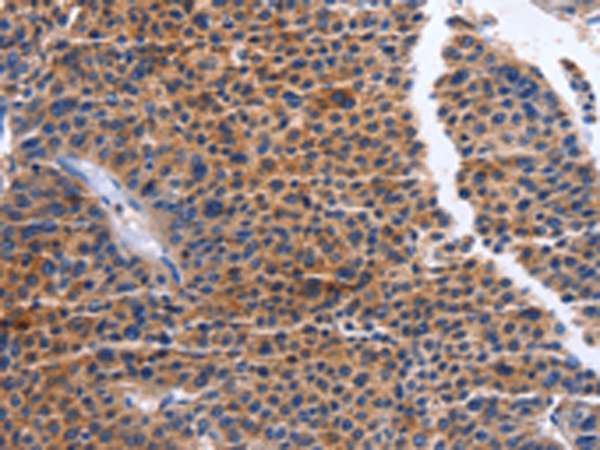 Rabbit Polyclonal Antibody to MAP3K13