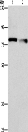 Rabbit Polyclonal Antibody to NEK11