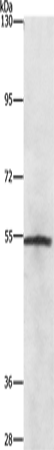 Rabbit Polyclonal Antibody to NEK2