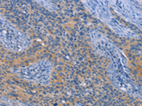 Rabbit Polyclonal Antibody to NEK8