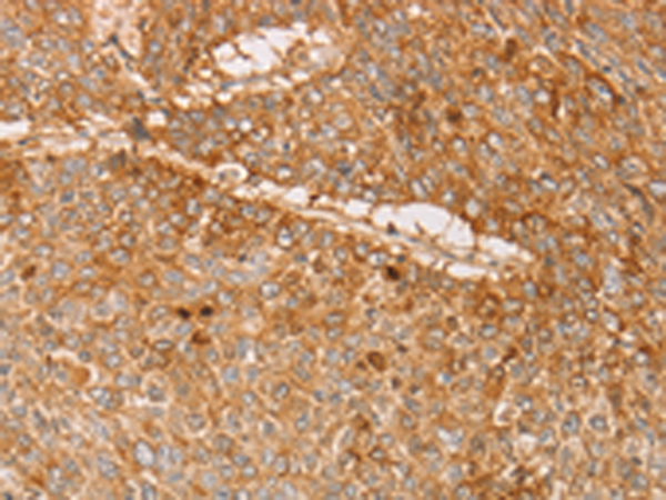 Rabbit Polyclonal Antibody to PACSIN2