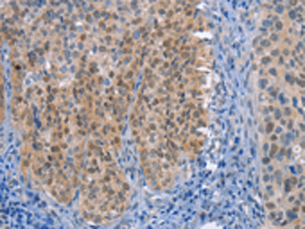 Rabbit Polyclonal Antibody to UCK1