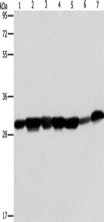 Rabbit Polyclonal Antibody to AK2