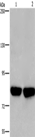 Rabbit Polyclonal Antibody to PFKP