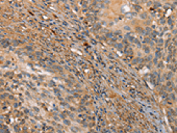 Rabbit Polyclonal Antibody to HK3