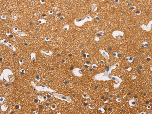 Rabbit Polyclonal Antibody to HK1/HK2