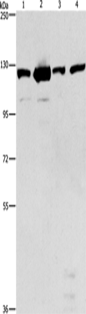 Rabbit Polyclonal Antibody to PTK2
