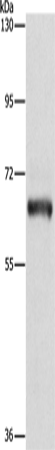Rabbit Polyclonal Antibody to KLC1
