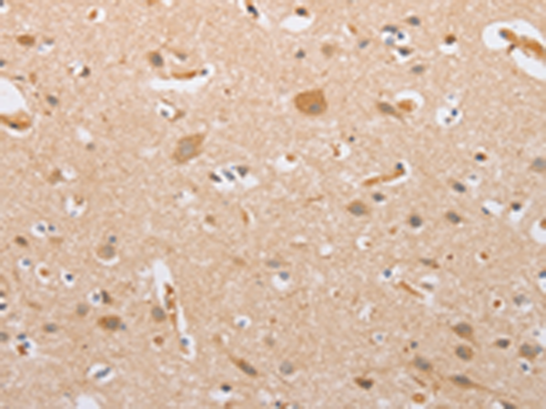 Rabbit Polyclonal Antibody to CSGALNACT2