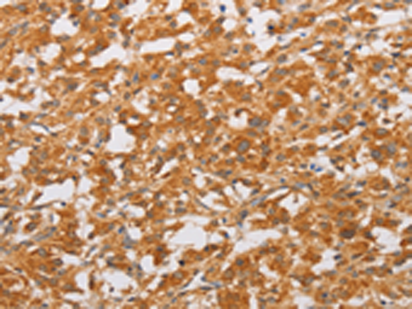 Rabbit Polyclonal Antibody to OLR1