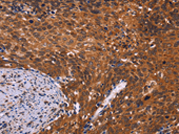 Rabbit Polyclonal Antibody to CDC5L