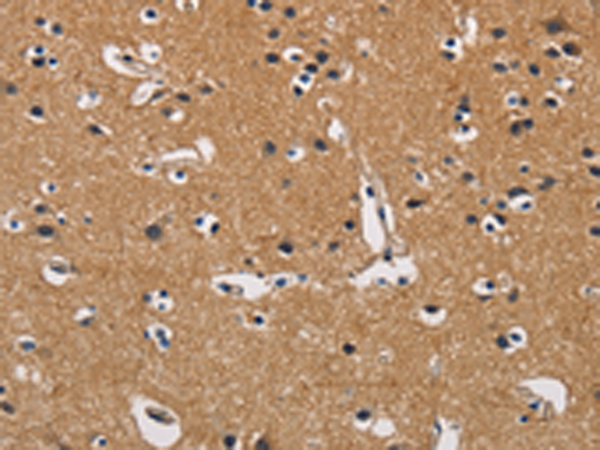 Rabbit Polyclonal Antibody to CBY1