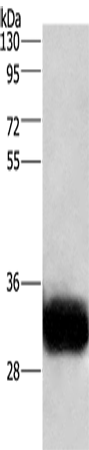 Rabbit Polyclonal Antibody to GPM6A