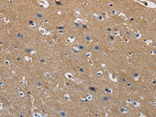 Rabbit Polyclonal Antibody to GSTA2
