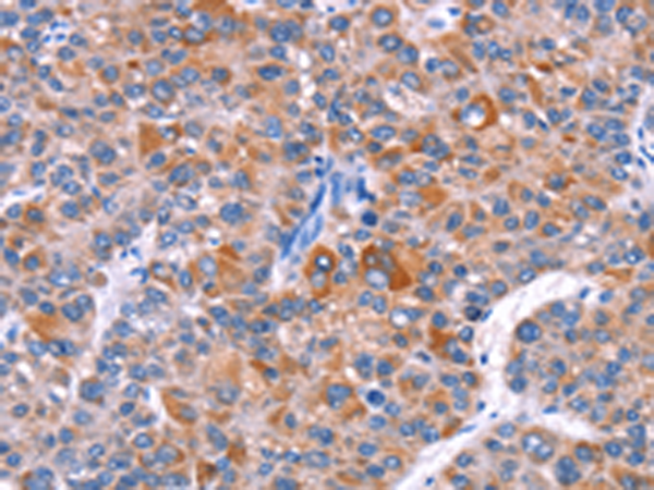 Rabbit Polyclonal Antibody to ELP2