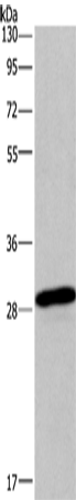 Rabbit Polyclonal Antibody to BNIP3