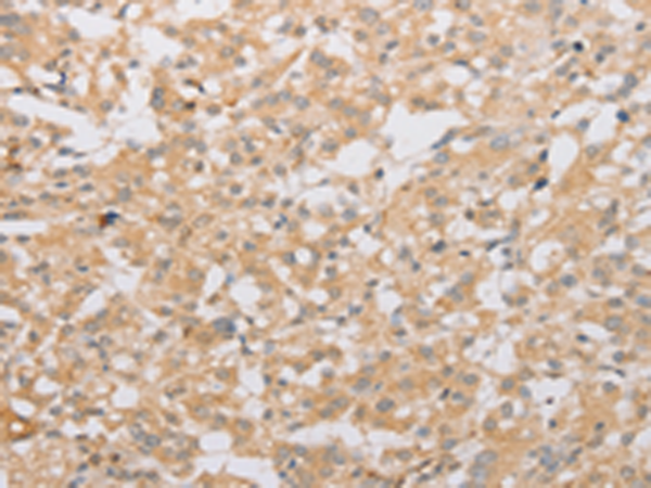 Rabbit Polyclonal Antibody to ATG9A