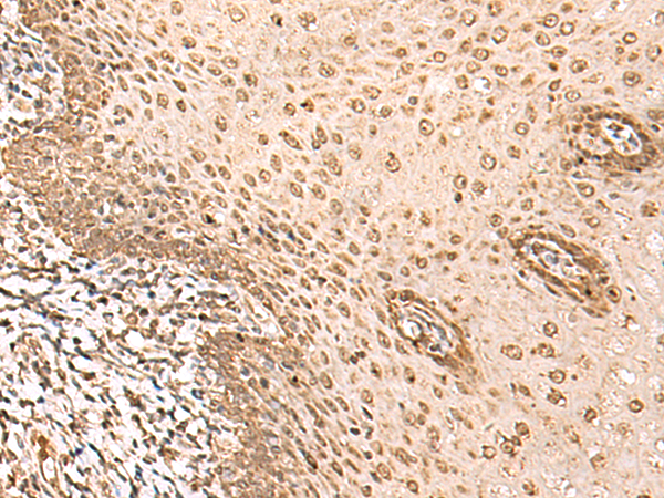 Rabbit Polyclonal Antibody to BAP1