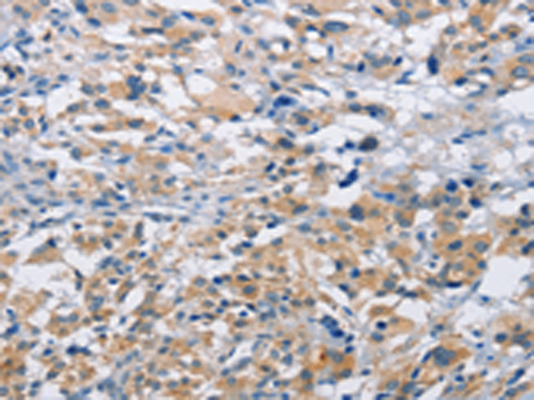 Rabbit Polyclonal Antibody to MTMR4
